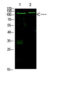Rb (Acetyl-K873/K874)