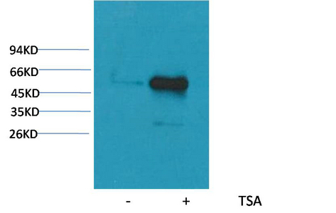 α-tubulin (Acetyl Lys40)(4A8)(4A8)