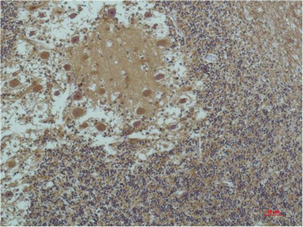 Mouse Monoclonal Antibody to α-tubulin (Acetyl Lys40)