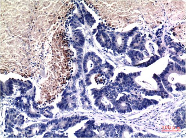 Mouse Monoclonal Antibody to Acetyl-Histone H3 (K9)