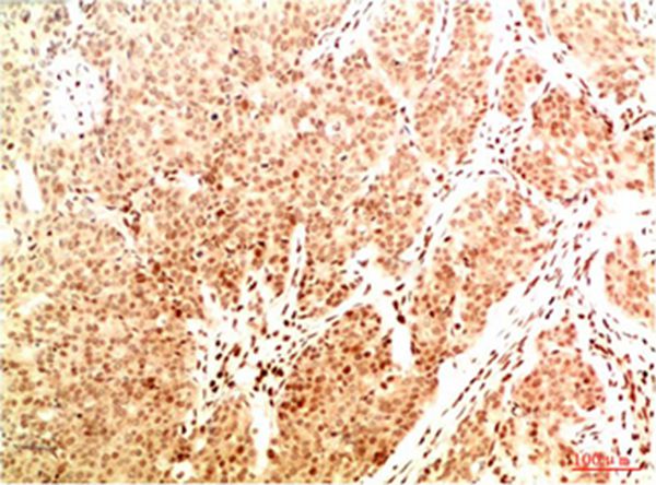 Acetyl NF kB P65(K314/K315) (2A11)