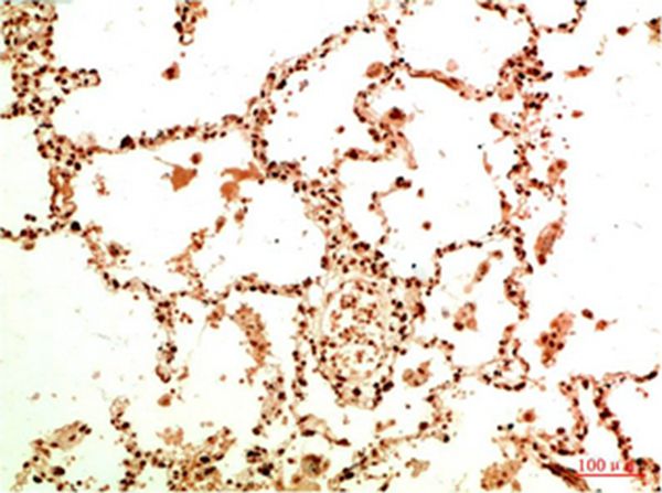 Mouse Monoclonal Antibody to Acetyl NF kB P65 (K314/K315)