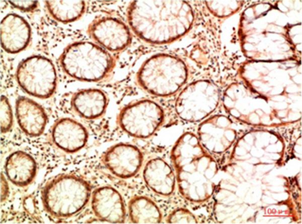Mouse Monoclonal Antibody to Acetyl P53(K382)