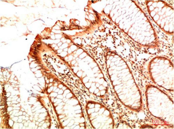 Mouse Monoclonal Antibody to Acetyl P53(K382)