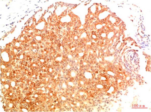 Mouse Monoclonal Antibody to Acetyl P53(K382) 