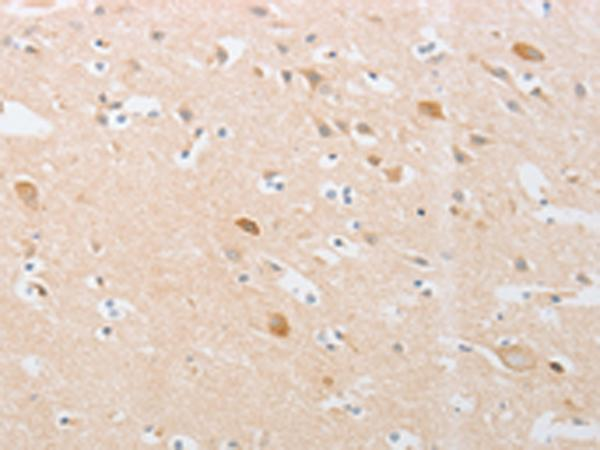 从表达纯化到验证:昆虫细胞蛋白表达全攻略