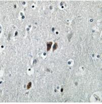 Rabbit Polyclonal Antibody to C17