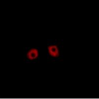 Rabbit Polyclonal Antibody to Frizzled 1/2/7