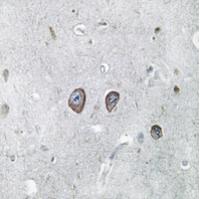 Rabbit Polyclonal Antibody to Panopsin