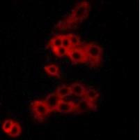 Rabbit Polyclonal Antibody to Panopsin