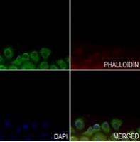 Rabbit Polyclonal Antibody to GPR143