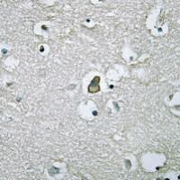 Rabbit Polyclonal Antibody to TMEM145