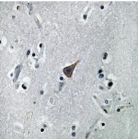 Rabbit Polyclonal Antibody to SLC6A16