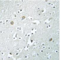 Rabbit Polyclonal Antibody to PLA1A