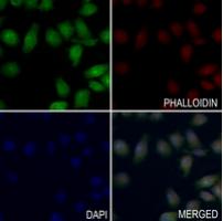 Rabbit Polyclonal Antibody to MTA1