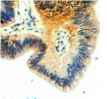 Rabbit Polyclonal Antibody to Claudin 17