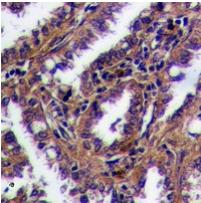 Rabbit Polyclonal Antibody to GPR169