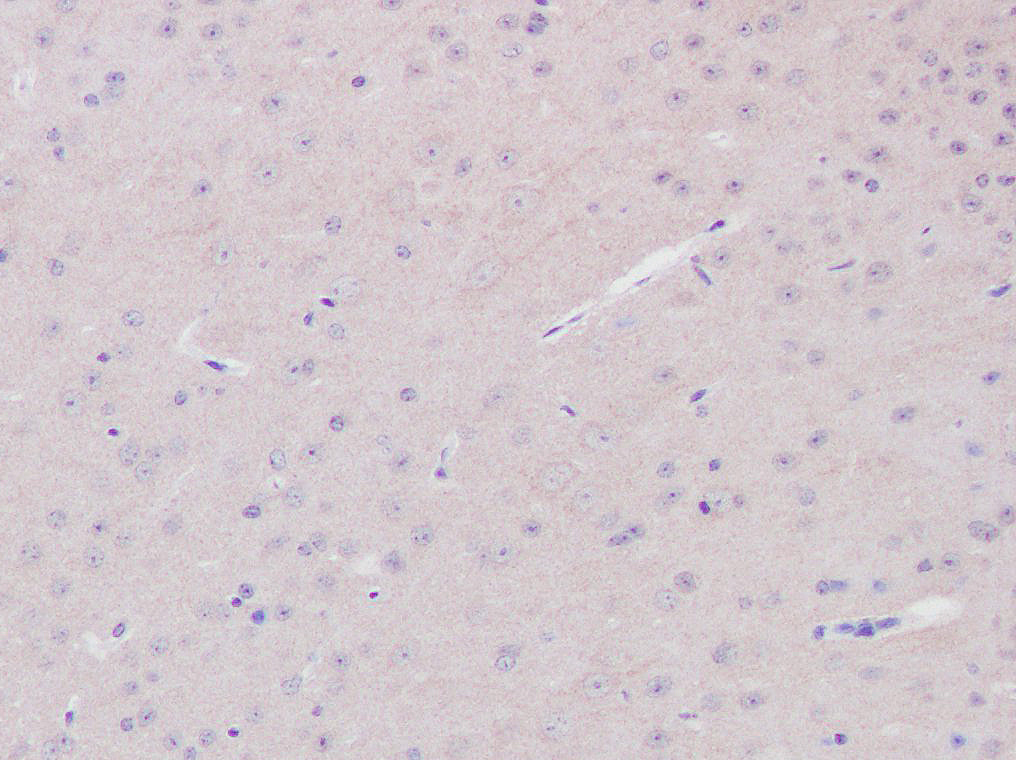 Rabbit Monoclonal Antibody to Recombinant Tau(Phospho-Thr181) Rabbit mAb(G69)