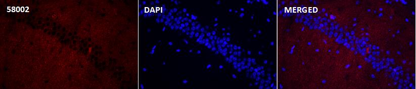 Rabbit Monoclonal Antibody to Recombinant Tau(Phospho-Thr181) Rabbit mAb(G69)