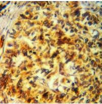 Rabbit Polyclonal Antibody to FUK