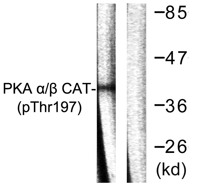Phospho-PKA alpha/beta/gamma (Thr197)