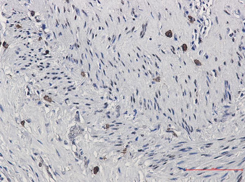 Rabbit Monoclonal Antibody to Phospho-CREB (Ser133)