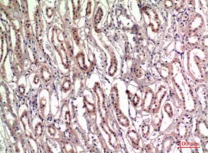 Rabbit Polyclonal Antibody to TNC