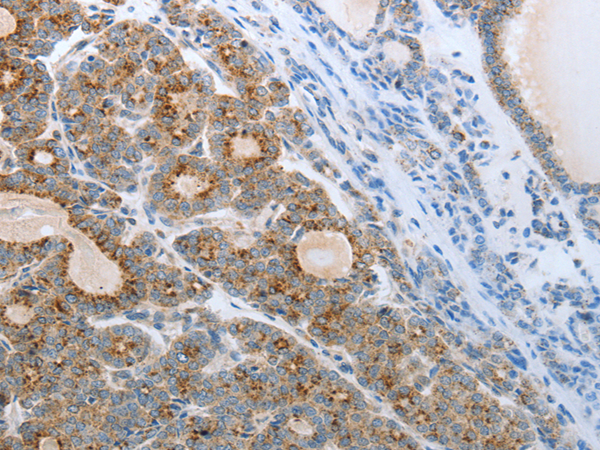 Rabbit Polyclonal Antibody to CEACAM5-远泰生物