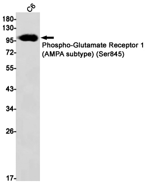 Rabbit Monoclonal Antibody to Phospho-Glutamate Receptor 1 (AMPA Subtype) (Ser845)