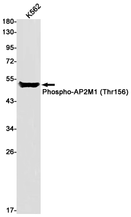 Phospho-AP2M1 (Thr156)