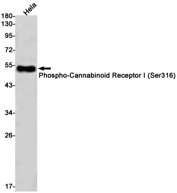 Phospho-Cannabinoid Receptor I (Ser316)