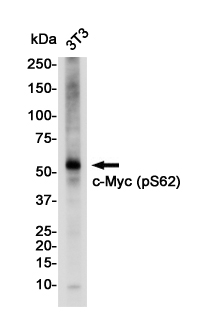 Rabbit Monoclonal Antibody to Phospho-c-Myc (Ser62)