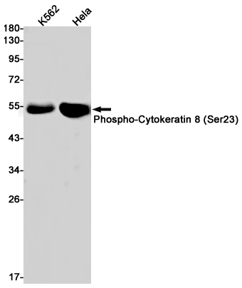 Phospho-Cytokeratin 8 (Ser23)