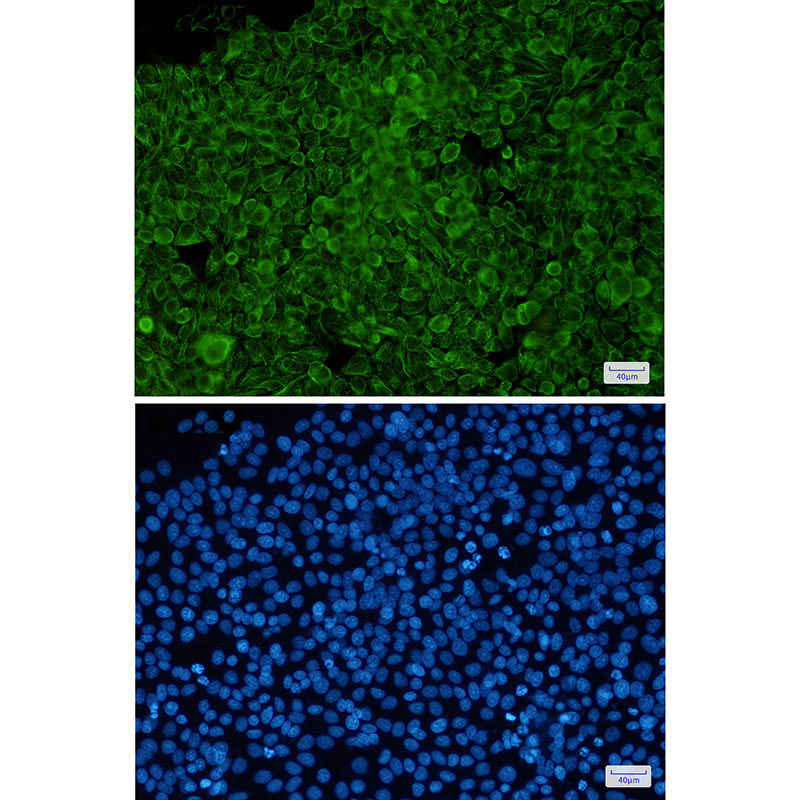 Rabbit Monoclonal Antibody to Phospho-Cytokeratin 8 (Ser23)