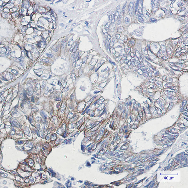 Rabbit Monoclonal Antibody to Phospho-Cytokeratin 8 (Ser23)