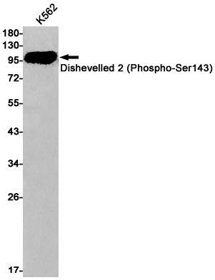 Phospho-Dishevelled 2 (Ser143)