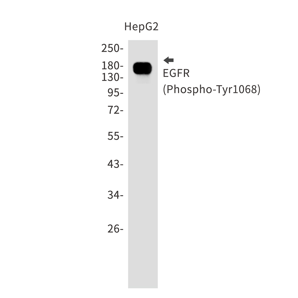 Phospho-EGFR (Tyr1068)