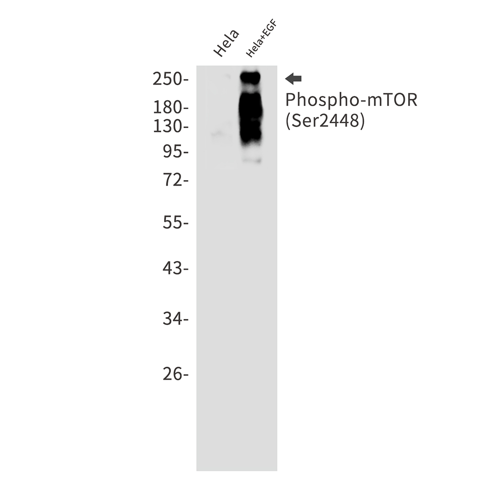 Phospho-mTOR (Ser2448)