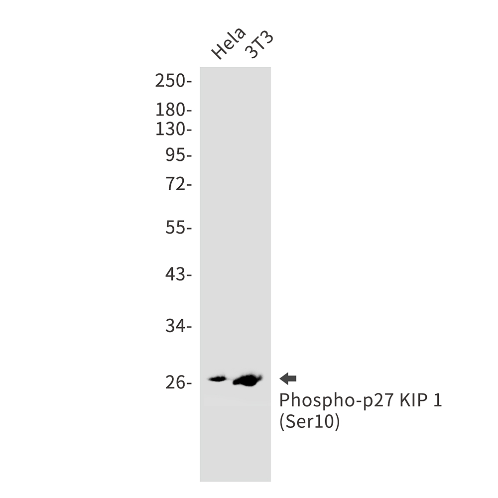 Phospho-p27 Kip 1 (Ser10)