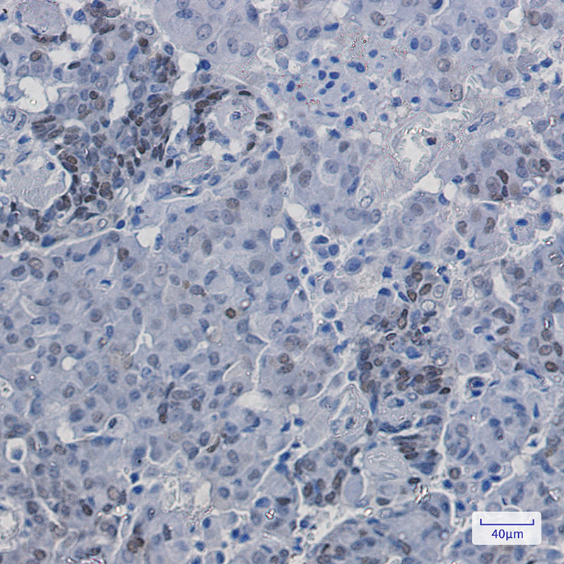 Rabbit Monoclonal Antibody to Phospho-p27 Kip 1 (Ser10)