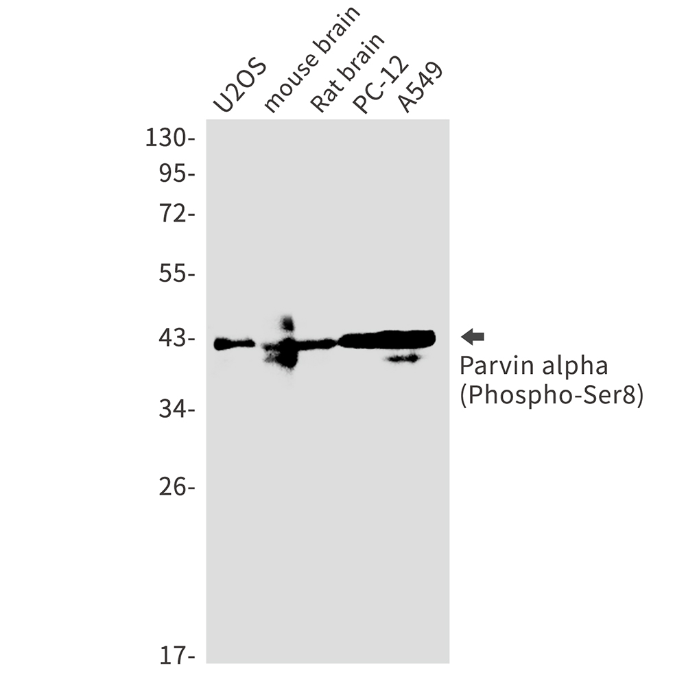 Phospho-Parvin alpha (Ser8)