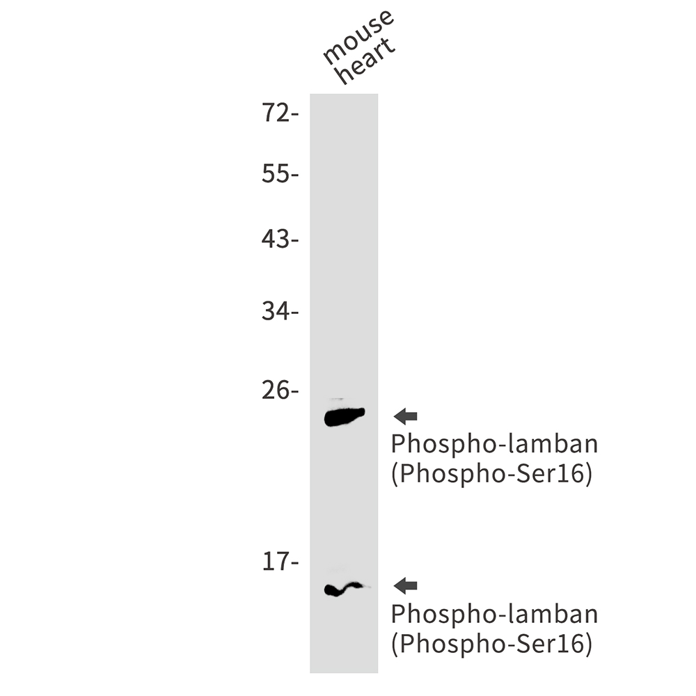 Phospho-Phospholamban (Ser16)