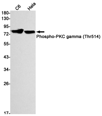 Rabbit Monoclonal Antibody to Phospho-PKC gamma (Thr514)