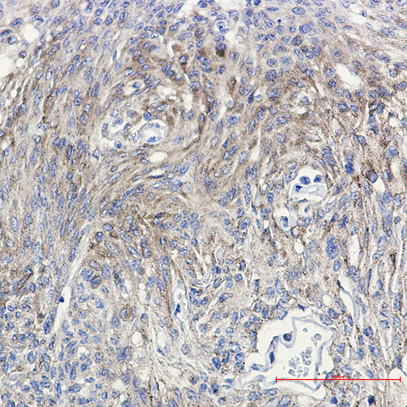 Rabbit Monoclonal Antibody to Phospho-PKC gamma (Thr514)