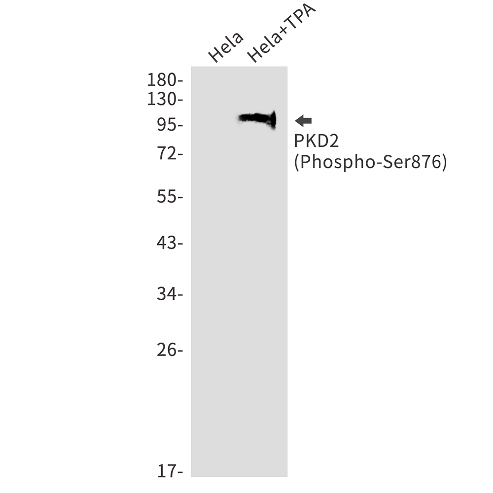 Phospho-PRKD2 (Ser876)