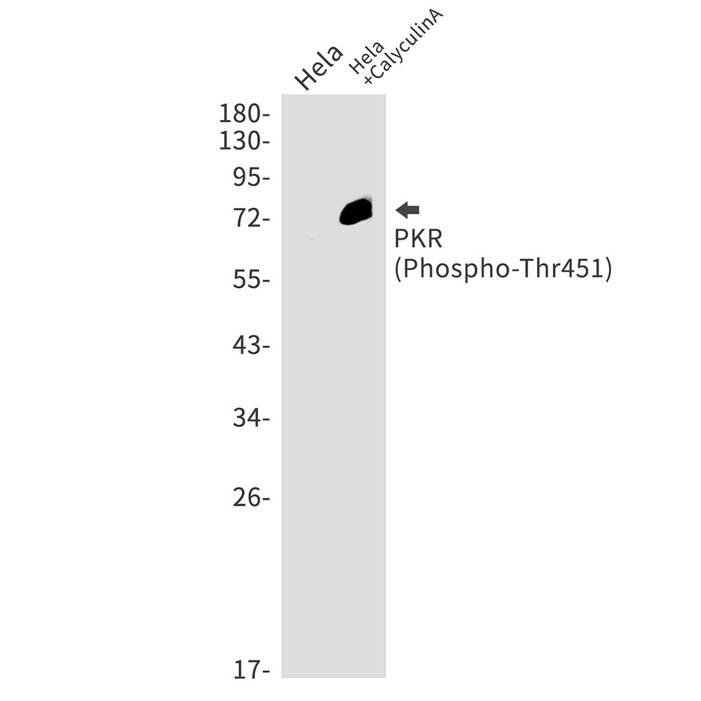 Phospho-PKR (Thr451)