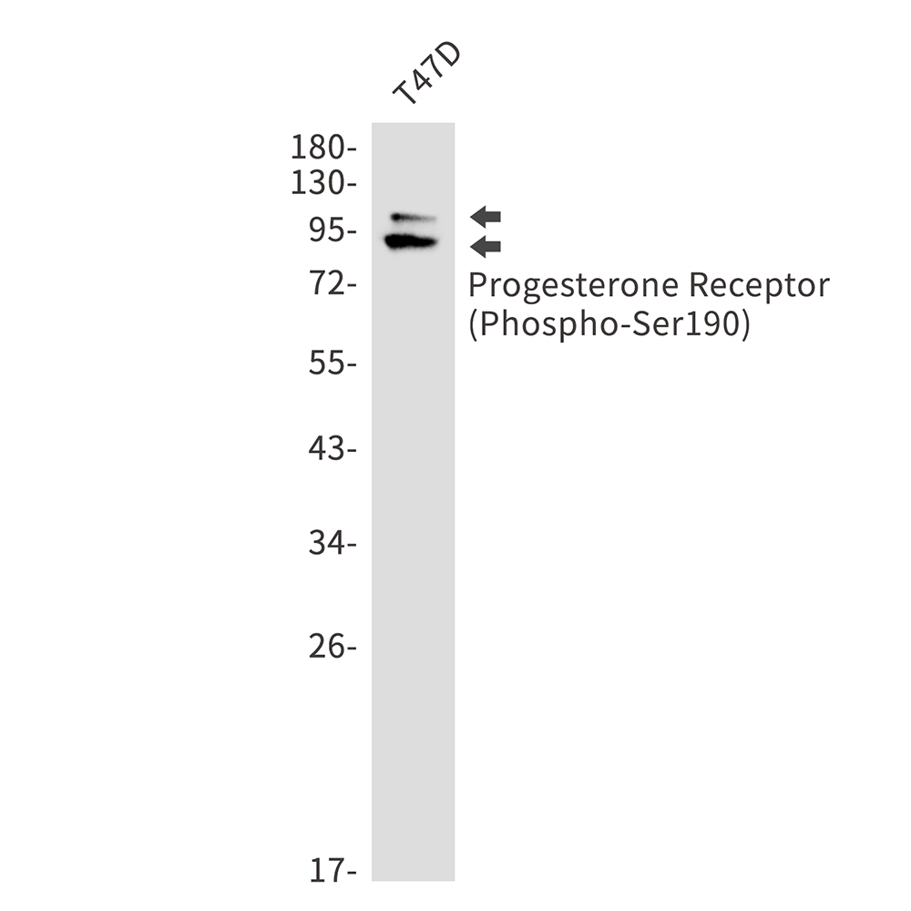 Phospho-Progesterone Receptor (Ser190)
