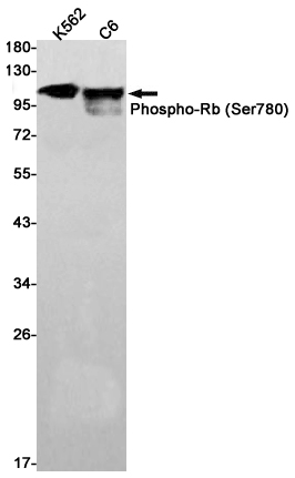 Phospho-Rb (Ser780)