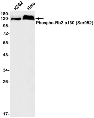Phospho-Rb2 p130 (Ser952)