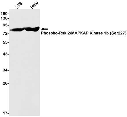 Rabbit Monoclonal Antibody to Phospho-RSK2 (Ser227)